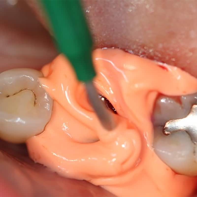 NoCord VPS being used for Impression
